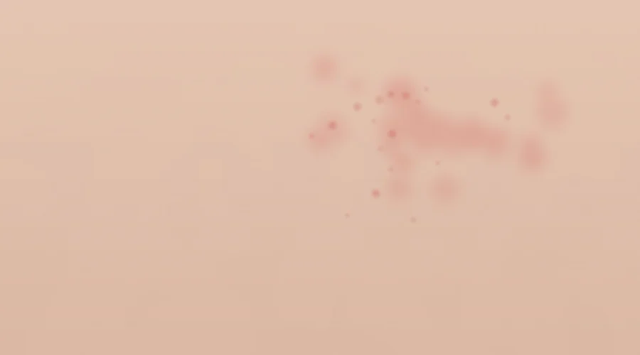 Close-up of baby skin with a mild heat rash being scanned